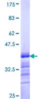 Human BACH1 Protein (Recombinant GST, N-terminus)