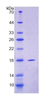 Mouse CD209 / DC-SIGN Protein (Recombinant His-T7)