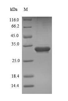 Mouse ESM1 / Endocan Protein (Recombinant 6His-SUMO, N-terminus)