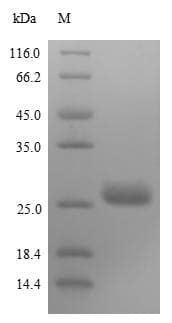Rabies Virus SARS-CoV Matrix Protein (Recombinant 10His, N-terminus + Myc, C-terminus)