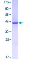 Human KRAS Protein (Recombinant GST)