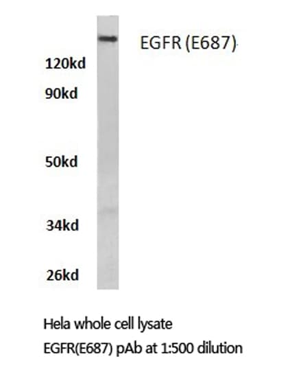Polyclonal Rabbit anti-Human EGFR Antibody (Glu687, IHC, IF, WB)
