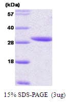 Human YWHAE / 14-3-3 Epsilon Protein (Recombinant)