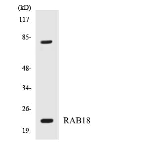 Polyclonal Rabbit anti-Human RAB18 Antibody (aa89-138, WB)