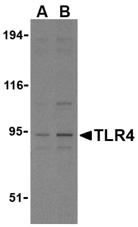 Polyclonal Rabbit anti-Human TLR4 Antibody (IHC, IF, WB)