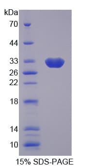 Rat FSP27 / CIDEC Protein (Recombinant His-T7)