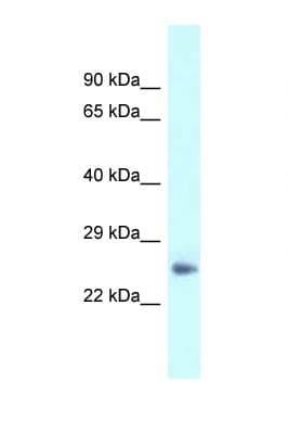 Polyclonal Rabbit anti-Mouse Dermatopontin / DPT Antibody (aa45-94, WB)