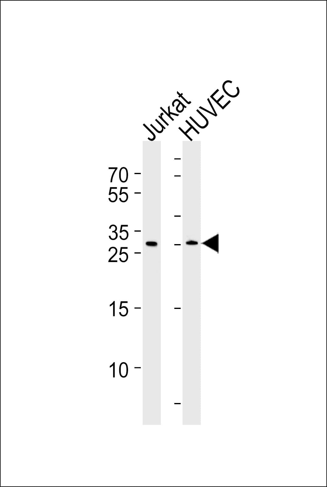 DKK4 Antibody (aa162-189)