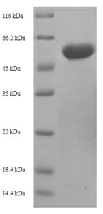 Mouse OGDH Protein (Recombinant 6His-SUMO, N-terminus)