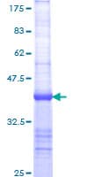 Human BIRC1 / NAIP Protein (Recombinant GST, N-terminus)