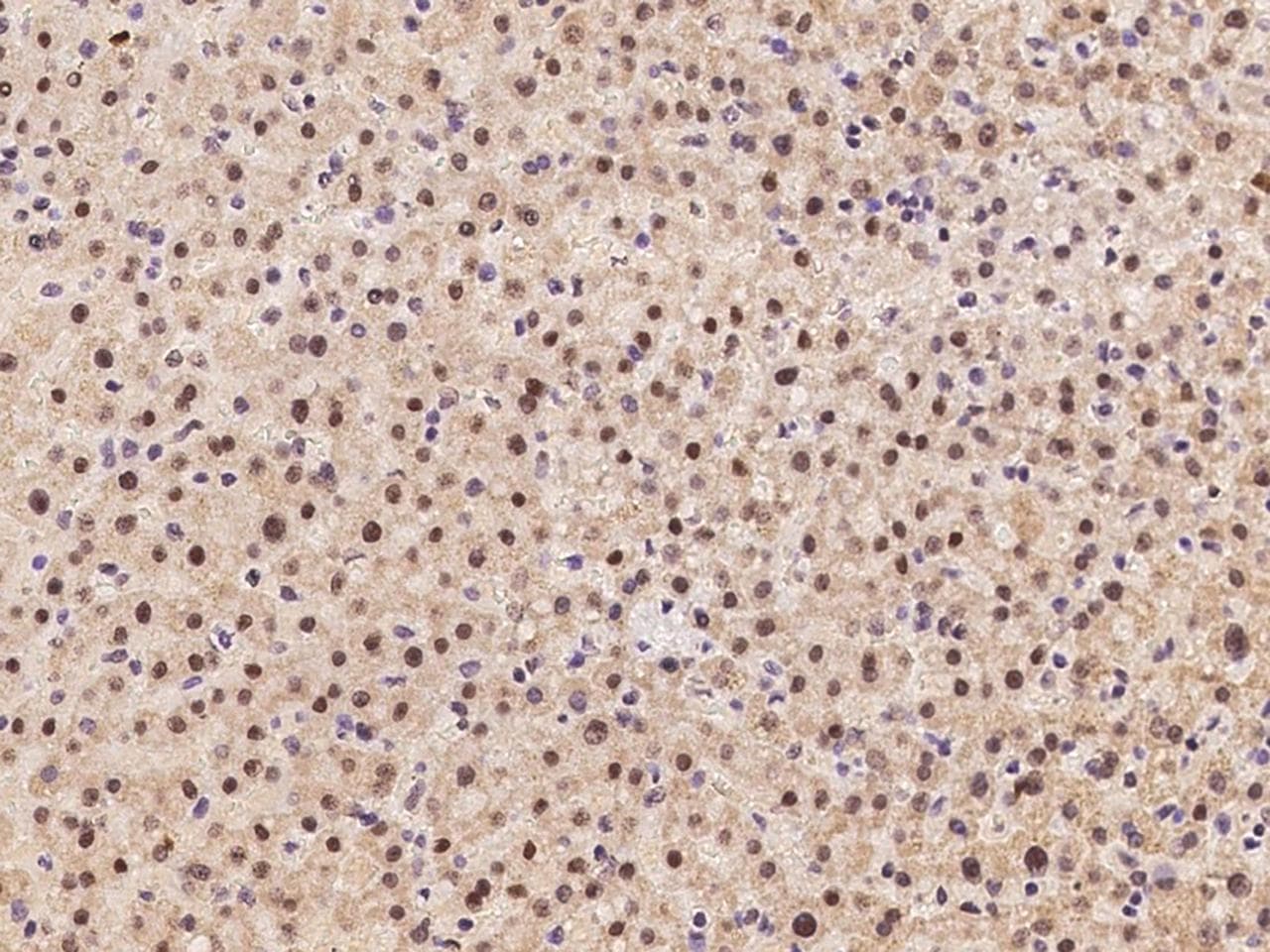 SLBP Antibody