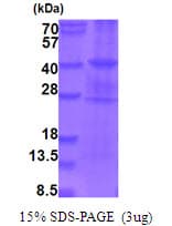 Human BRAF / B-Raf Protein (Recombinant His)