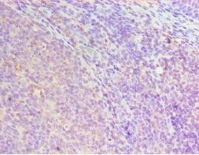 Polyclonal Rabbit anti-Human HOXA1 Antibody (aa75-205, IHC)
