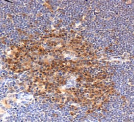 PFN1 / Profilin 1 Antibody (C-Terminus)