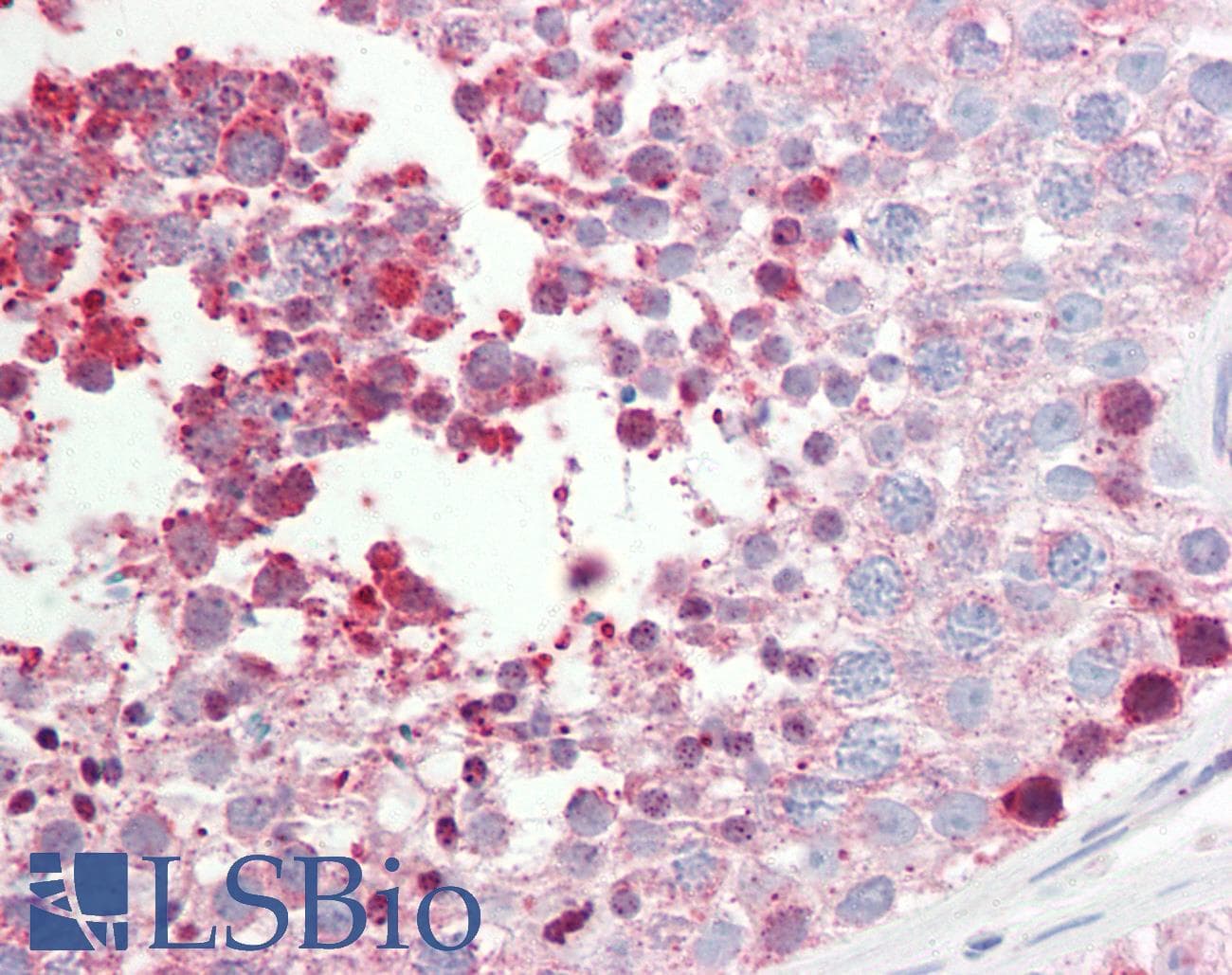 IHC-plus™ Polyclonal Rabbit anti-Human CNGA2 Antibody (aa190-218, IHC, WB)