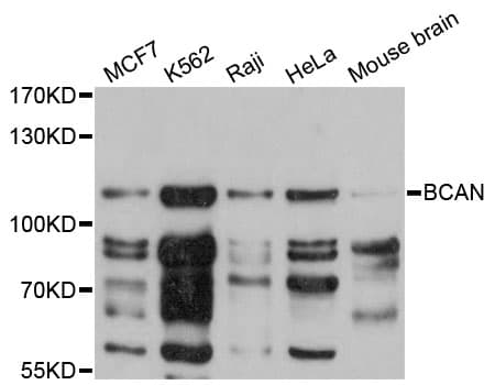 Polyclonal Rabbit anti-Human BCAN / Brevican Antibody (WB)