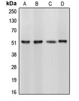 Polyclonal Rabbit anti-Human CELF1 / CUGBP1 Antibody (Internal, IHC, IF, WB)