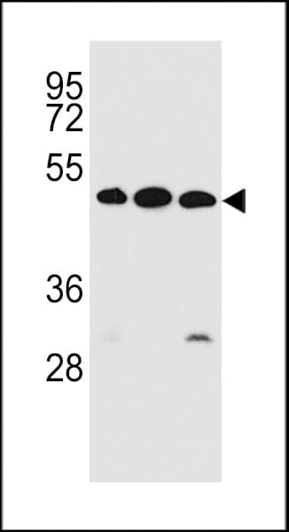 Polyclonal Rabbit anti-Human KREMEN2 Antibody (aa248-276, WB)