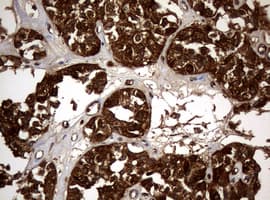 NME1 / NM23 Antibody (clone OTI2A5)