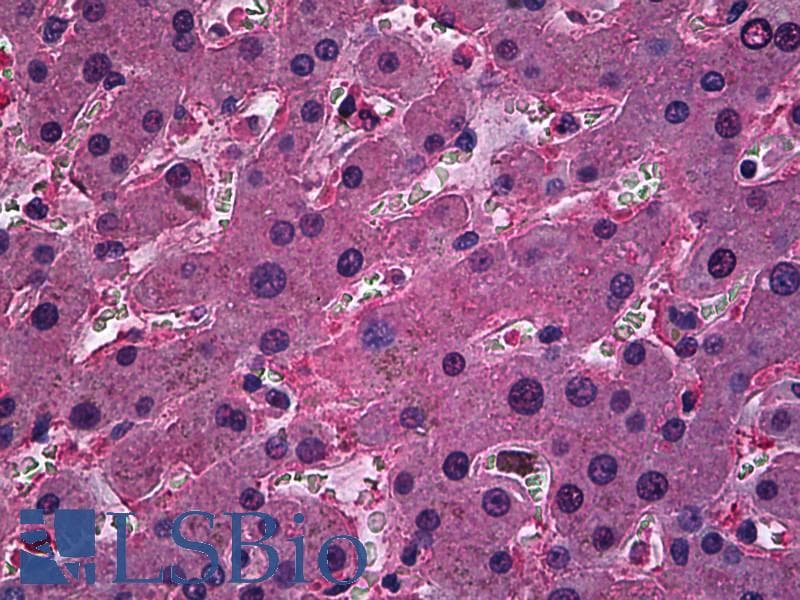 IHC-plus™ ORM1 / Orosomucoid Antibody (clone 2F9-1F10)