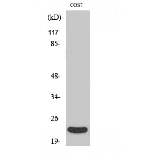 LTA / TNF Beta Antibody (Internal)