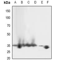 Polyclonal Rabbit anti-Human LAT Antibody (WB)
