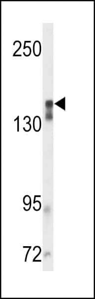 KDR / VEGFR2 / FLK1 Antibody
