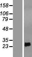 SPRYD4 Protein (Over-Expression Lysate Myc-DDK (Flag))
