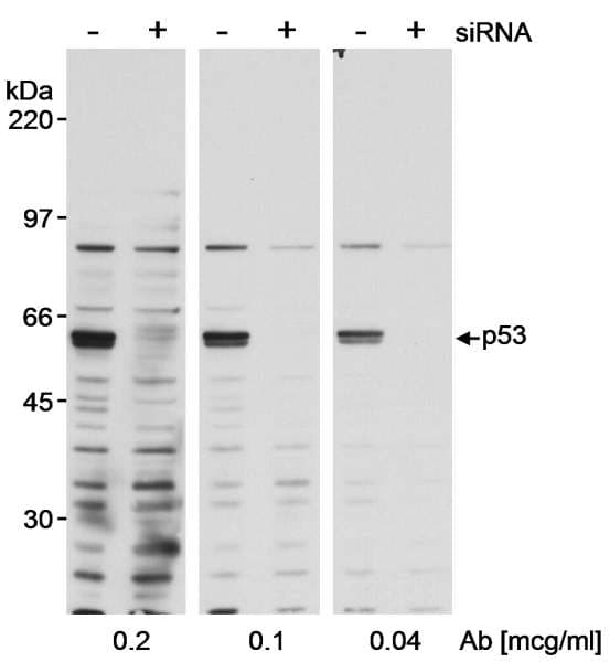 TP53 / p53 Antibody (aa375-C-term)