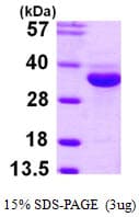 Human ENOPH1 / MASA Protein (Recombinant His)