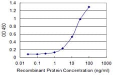 GJB1 / CX32 / Connexin 32 Antibody (clone 2B9)