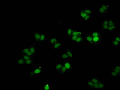 Polyclonal Rabbit anti-Human HIST1H1A Antibody (IF)