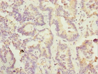 SIK3 / QSK Antibody