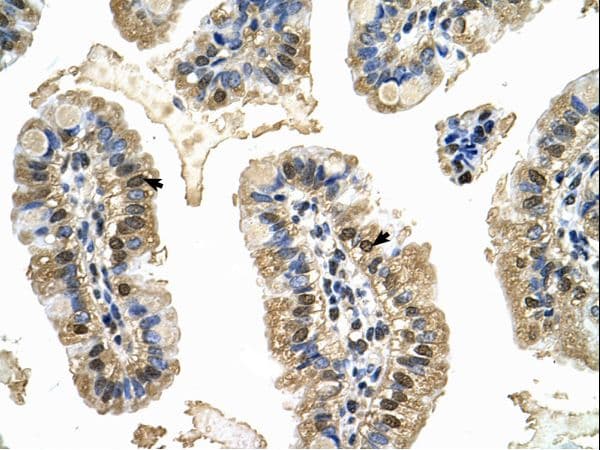 MCM8 Antibody (aa717-766)