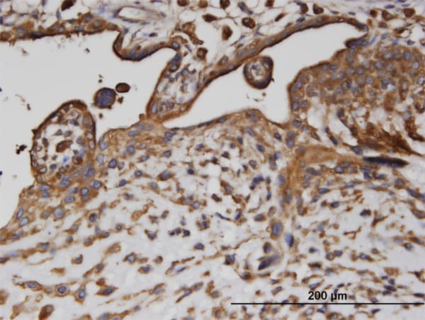 AP2B1 Antibody (clone 2D5)