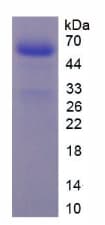 Human F10 / Factor X Protein (Recombinant His-GST, N-terminus)