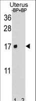 Polyclonal Rabbit anti-Human SH3BGRL Antibody (aa35-63, WB)