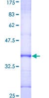 Human DKC1 / Dyskerin Protein (Recombinant GST, N-terminus)