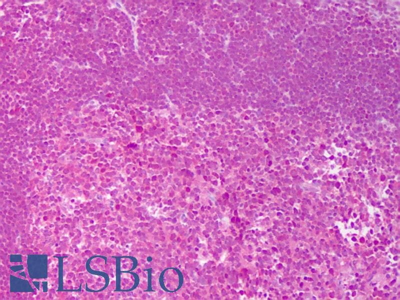 IHC-plus™ IL4 Antibody