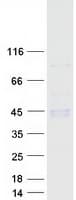 Human CD1B Protein (Recombinant Myc-DDK (Flag))