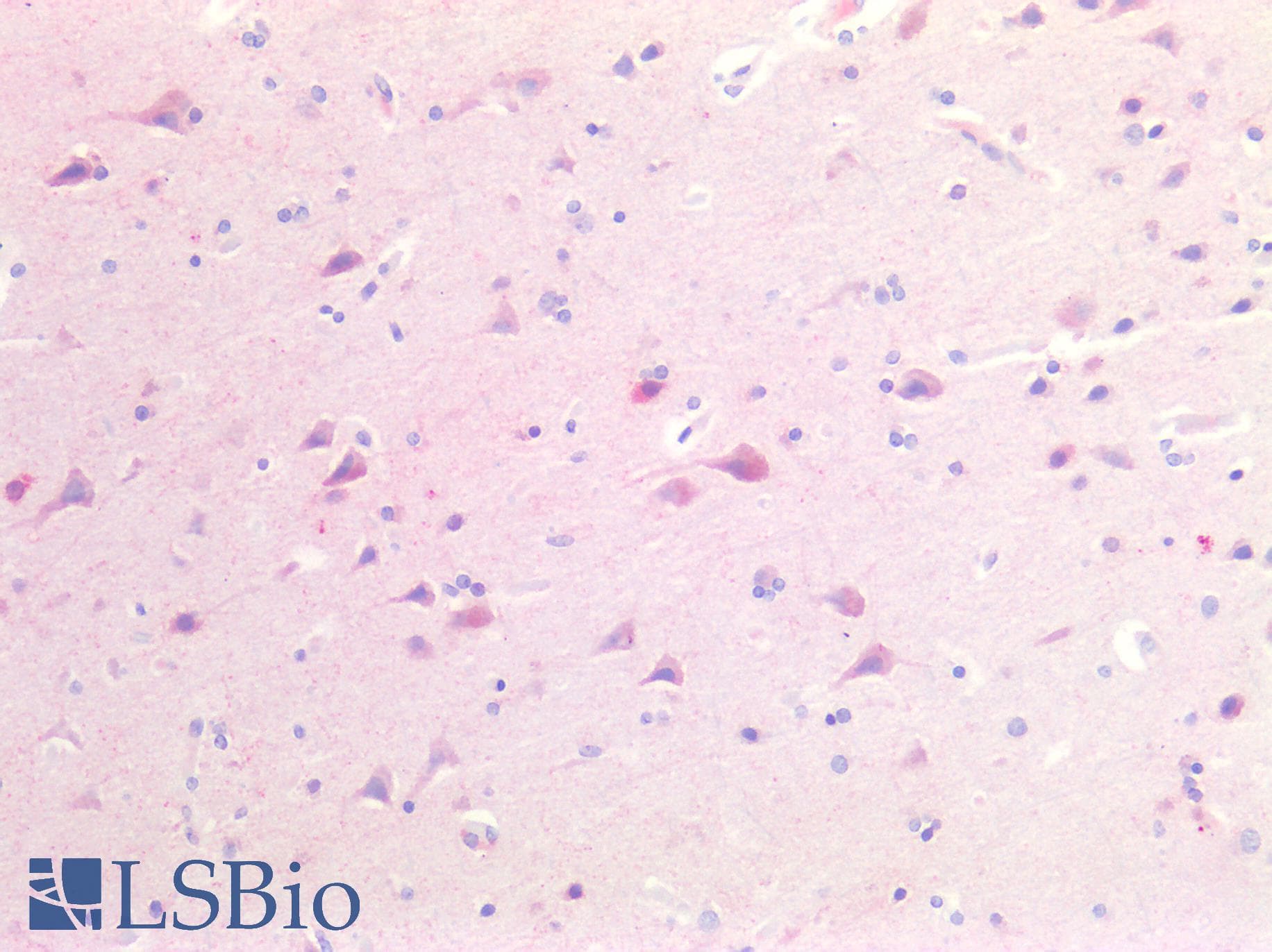 IHC-plus™ GAD65 Antibody