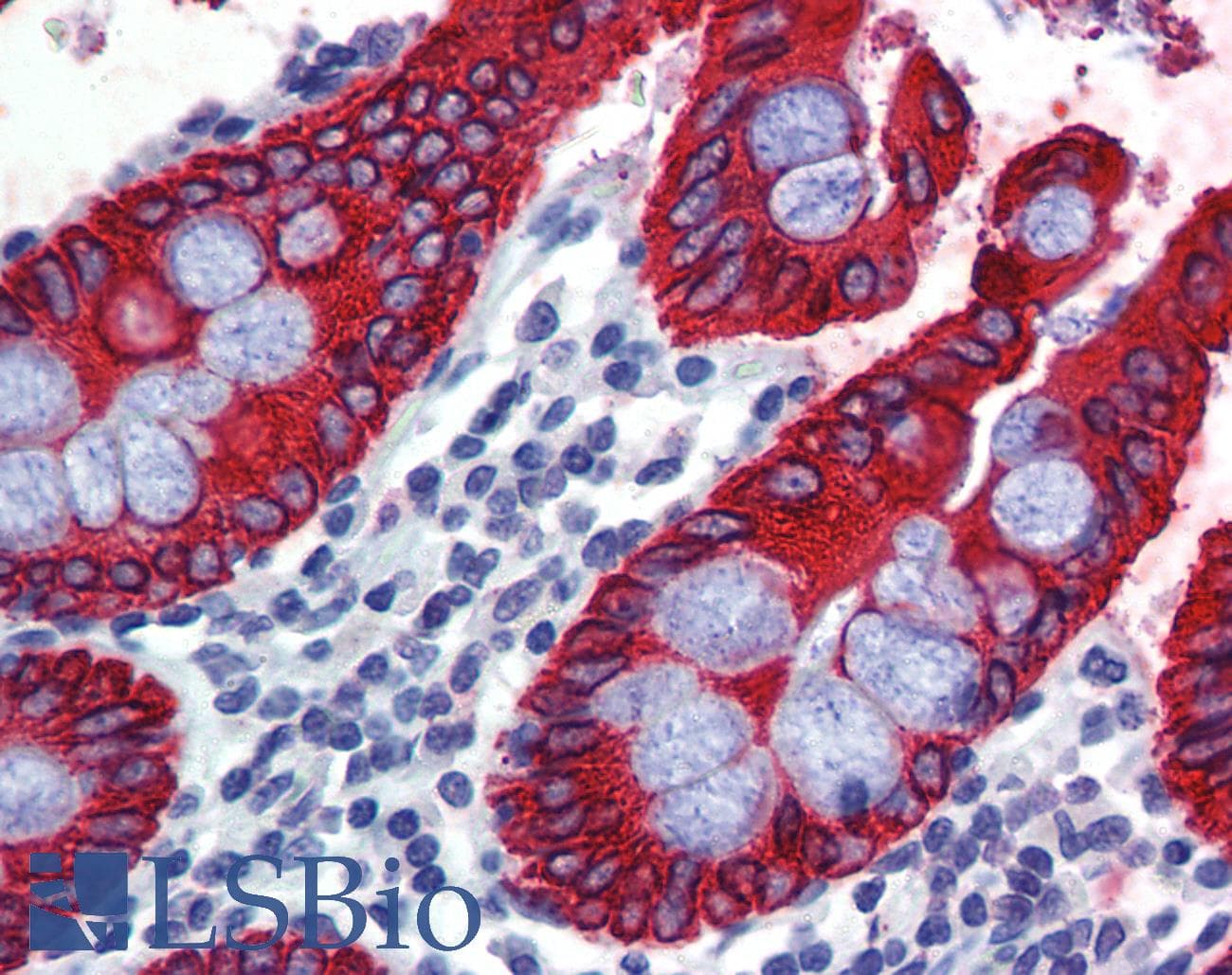 PathPlus™ Pan Cytokeratin Antibody (clone 7H8)