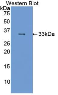 NCAM / CD56 Antibody (aa340-608)