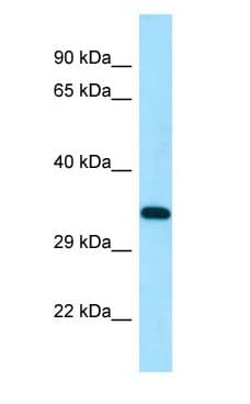 DSN1 Antibody (aa59-108)