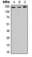 HEATR1 Antibody (Internal)