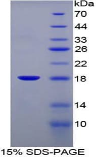 Mouse FABP1 / L-FABP Protein (Recombinant His-T7)