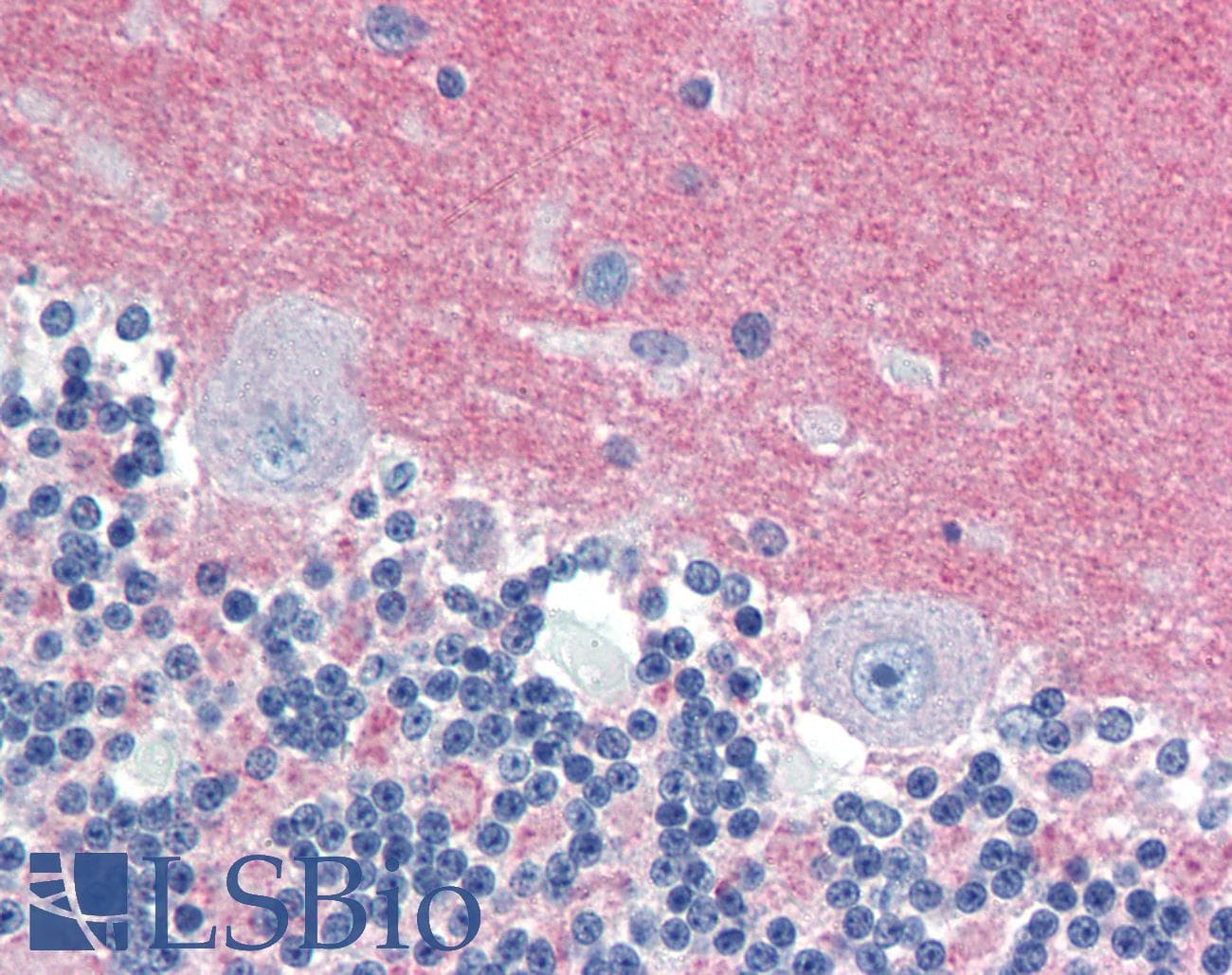 IHC-plus™ RAB3A Antibody (aa202-217)