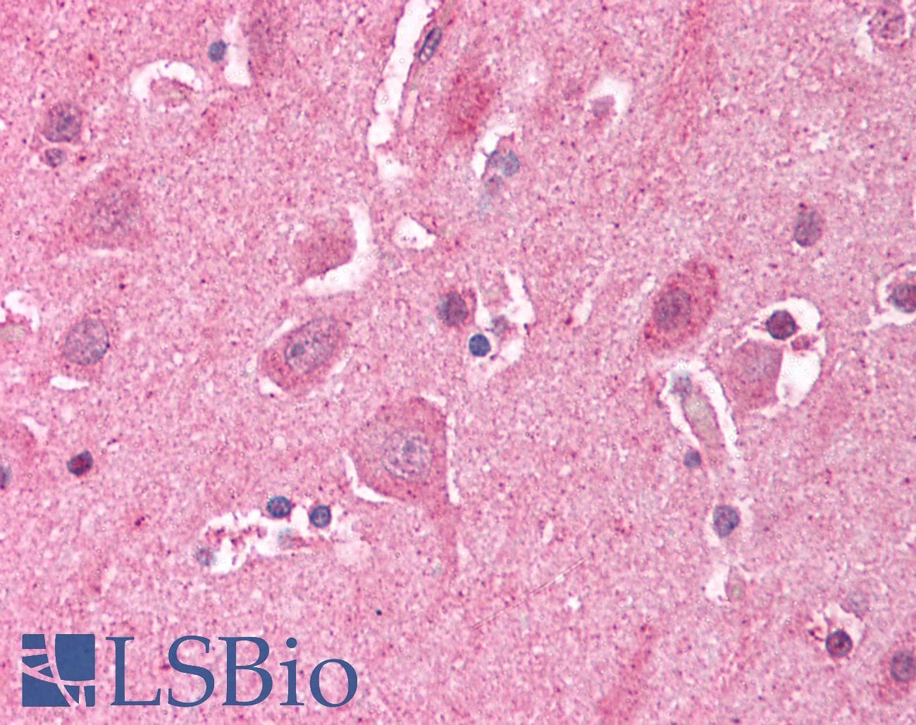 IHC-plus™ Polyclonal Rabbit anti-Mouse LDB2 Antibody (IHC, WB)