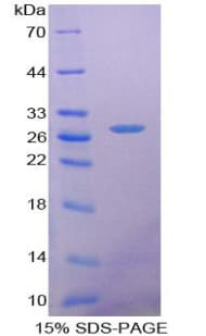 Mouse SFTPA1 / Surfactant Protein A (Recombinant His, N-Terminal)