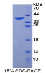 Human HSPA1A Protein (Recombinant His-T7)